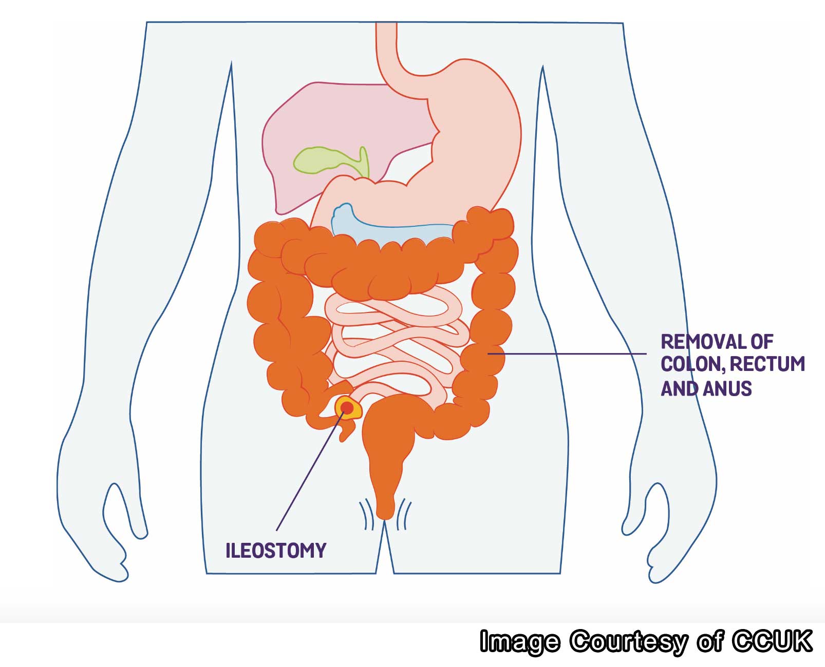 Services - The Colchester IBD centre